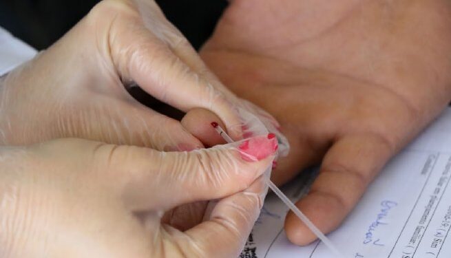 Prefeitura realiza evento de promoção à Saúde do Homem na próxima terça-feira (9) na USF Juquehy 2