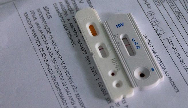 Julho Amarelo: São Sebastião realiza testes rápidos para detecção de Hepatites B e C e Sífilis
